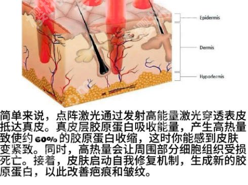 太原点阵激光哪里好？五大医院实力对比