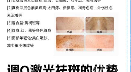 南昌激光祛斑一般需要多少费用一次？排行榜前三医院有实力