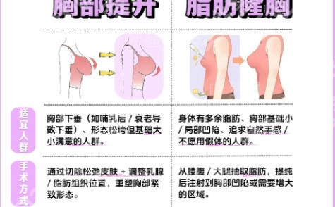 上海伊莱美隆胸价格？2025全新收费标准更新！