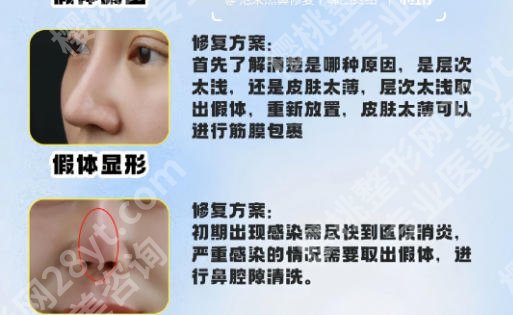 青岛鼻修复比较出名的医生(专家)有哪些？陈振雨、柯家祥等5位实力来袭