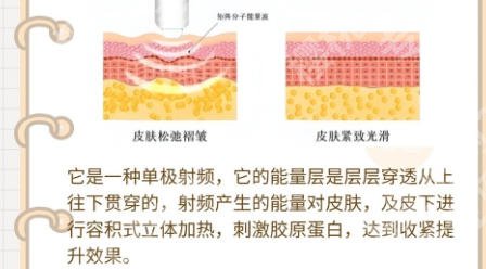 上海做热玛吉好的医院有哪些？上海第九医院、上海艺星实力上榜！