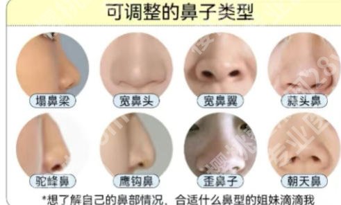 贵阳隆鼻哪家医院好？贵州医科大学附属医院、贵州省人民医院等口碑机构领衔！