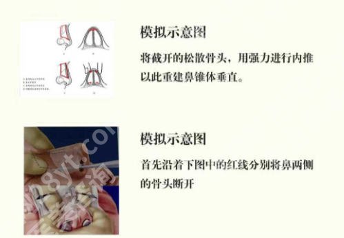 兰州鼻修复哪家医院好？公立三甲与口碑专科机构深度对比！