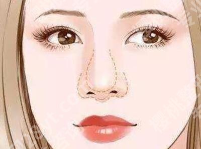 佛山做鼻子好的医生排名有哪些？do鼻子封神的有这几位大白