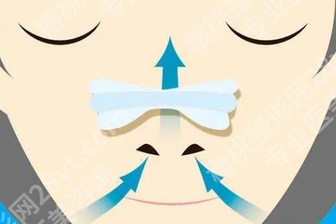 柳州鼻修复医院排名哪个好?5家正规机构闭眼冲,避坑不花冤枉钱