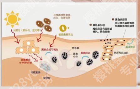 周口哪里有祛斑效果好的?五家本地人常去的正规医院深度盘点和技术口碑全解析!!