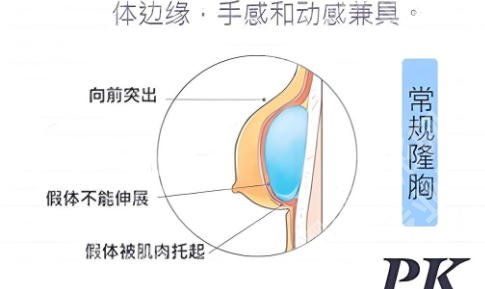 暨南大学附属第一医院丰胸专家有哪些？肖丽玲、谢波等医生技术超群！