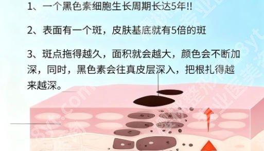 宁波激光祛斑的医院哪里好？附价格表、医院推荐与避坑指南！