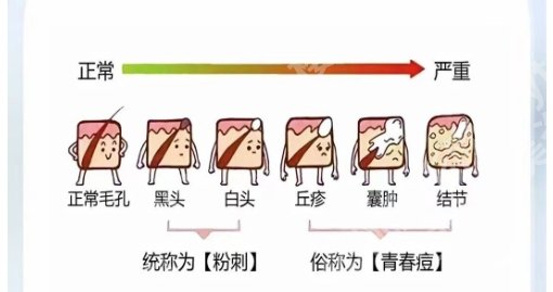 漳州激光祛痘医院哪里好？市医院、恩僖医学美容技术支持强、收费实在没套路！