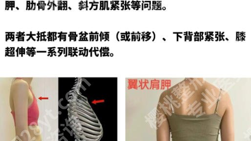 北京八大处缩胸优选删除的医生是谁啊？杨庆华、杨明勇等医生技术与价格全对比！