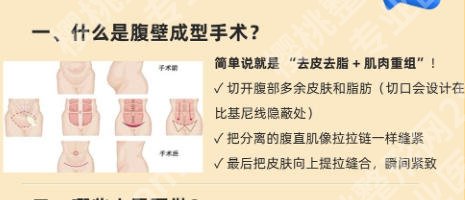 蚌埠第三人民医院腹壁整形专家有哪些？科室实力如何、医生专长解析与整形项目价格参考！