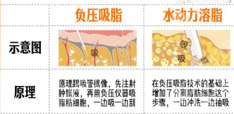 北京知音吸脂怎么样？看了技术优势+价格+患者真实案例特别靠谱！