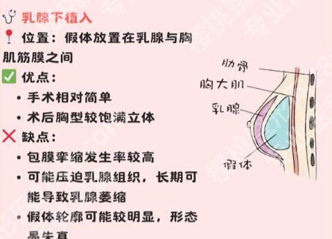 南京医科大学第二附属医院丰胸怎么样？含沈干、李昌等医生榜上有名！
