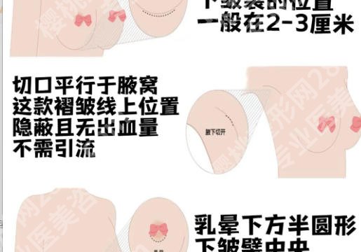 北京右安门医院隆胸专家有哪些？右安门医院医美科医生情况与术前塑美指南！