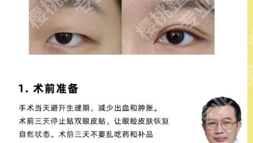 北京画美做双眼皮怎么样？医院资质/实力点评来了！含真实案例