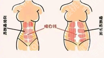 哈尔滨第五医院腹壁整形怎么样？医院资料、客户真实评价供你来看