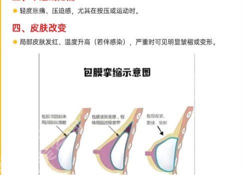 上海瑞金医院丰胸手术价格怎么样？价格低至2k起含章一新等人气医生推荐！