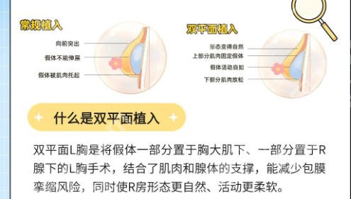 成都艺星隆胸价格是多少？2026年成都艺星假体与自体脂肪价格全览！