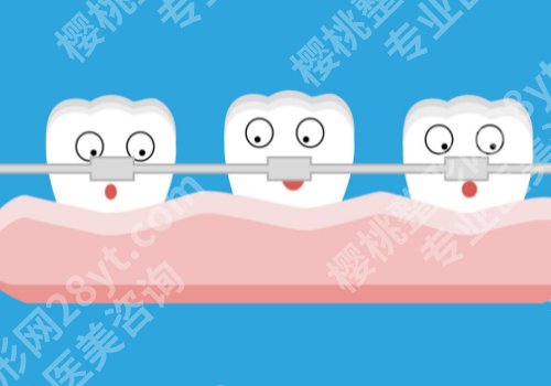 广州牙齿矫正好的医院！中山附属口腔医院、南方医大口腔医院等上榜