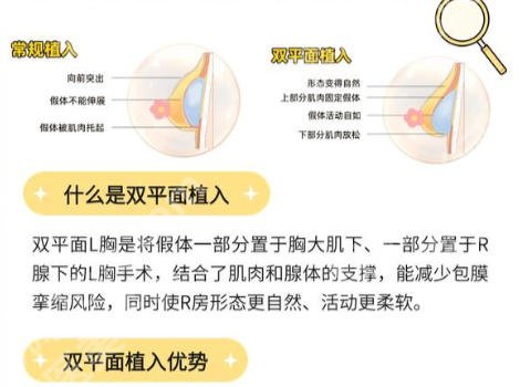 上海艺星隆胸多少钱？2026上海艺星隆胸价格表被扒快来看！