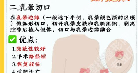 成都现代医院隆胸多少钱？价格低至1w起含医院简介、热点项目讲解及真实客户口碑来袭！