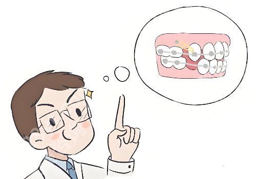 深圳牙齿矫正杨林医生怎么样？技术精湛_口碑好！附价格表