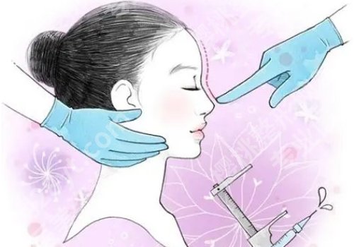 徐永丰医生做鼻子怎么样？技术成熟、审美在线、经验够硬