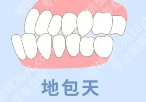 成都牙齿矫正的费用多少?1万元起,2026人气医院详情分享
