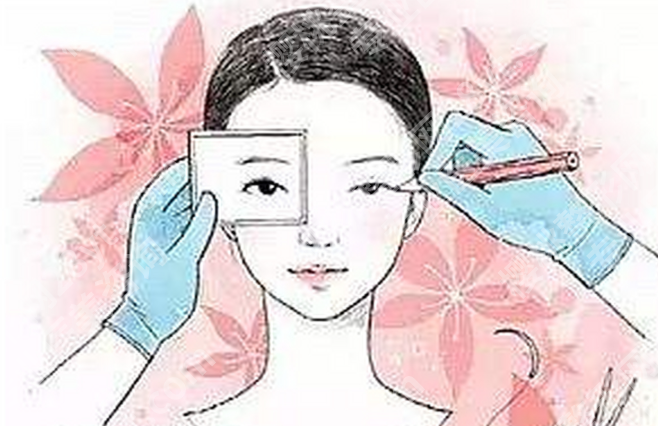 伊春哪家做双眼皮好?本地人气机构整理,想做先看看