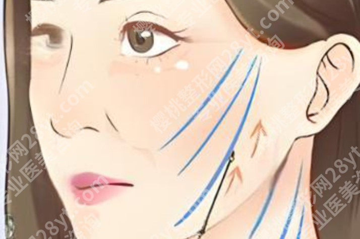 沈阳做拉皮手术哪家医院好？热门医院盘点好了，想做先收藏