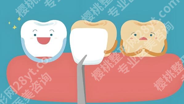 南京种牙多少钱一颗？更新2026价格信息，附项目科普