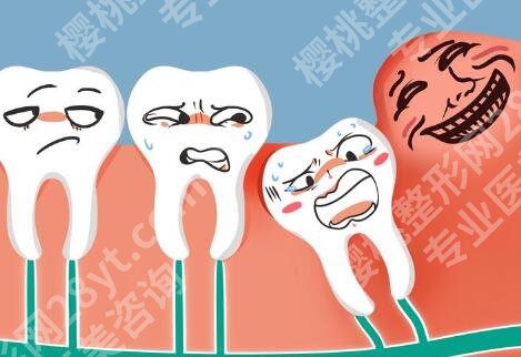 无锡种牙价格一般多少？价格常见误区分析，戳进来看
