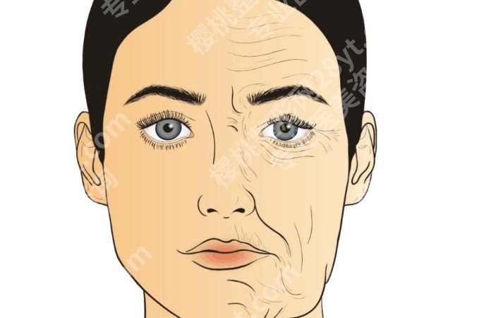 哈尔滨拉皮手术厉害三个科室有哪些？三家高关注科室整理好了可以先看