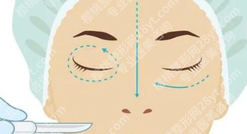 辽源割双眼皮哪家好?风格、价格和医院类型都值得一起比