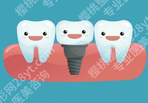 郑州种牙价格一览表！单颗牙仅需4000元起、医院TOP10公开