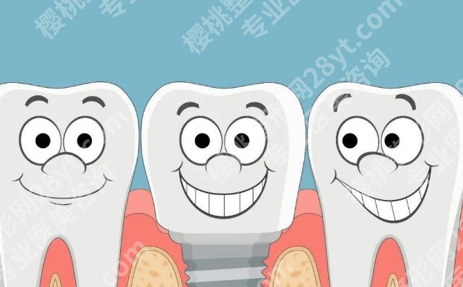 哈尔滨哪里种牙便宜又好呢？性价比高的机构藏不住了，本地人都在看