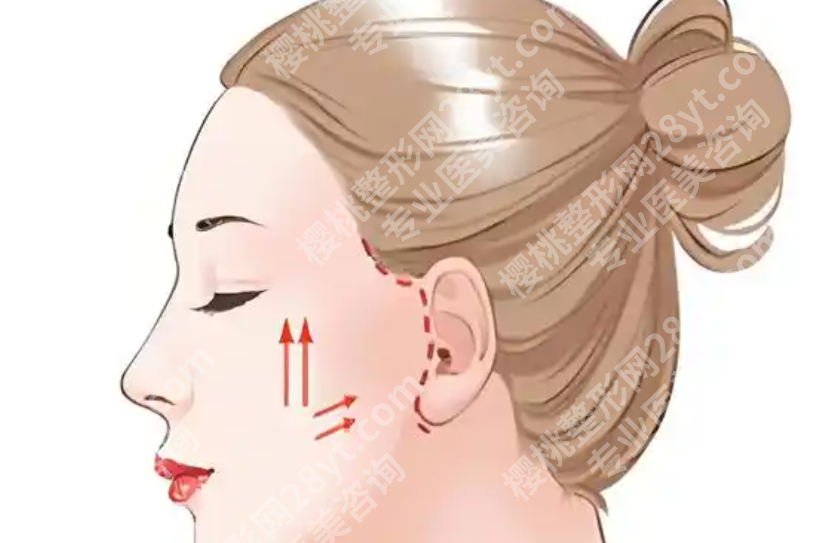 哈尔滨做拉皮手术的医生有哪些值得关注？经验、案例和审美风格是关键