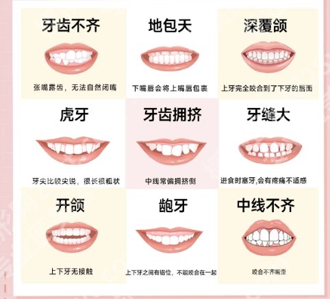 济南牙齿矫正价格费用贵不贵？收费细节展示！速速浏览