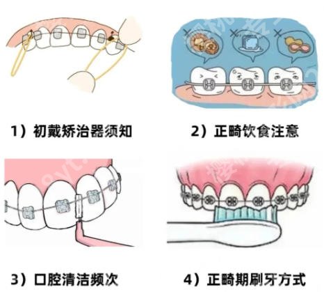 南昌牙齿矫正哪家医院好?五家口碑医院等你来选!个个实力超群