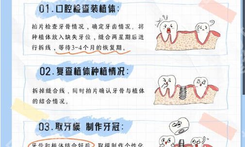 丽水种植牙口腔医院排名前十揭晓！这些医院个个实力派口碑技艺俱佳！