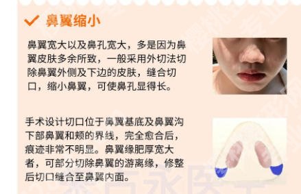 王滨福医生怎么样？含医生技术详解及实用小技巧！