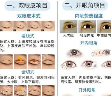 林忠泵医生双眼皮技术靠谱吗？亲测案例|2026价格清单公示！