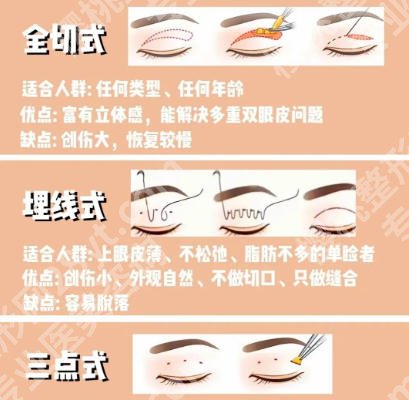 王博谦医生口碑如何？做双眼皮技术好吗？案例展示测评
