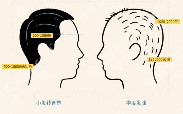 胡志奇医生厉害的三个项目盘点！审美好风格自然！