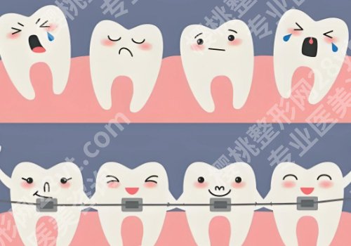 西安牙齿矫正费用一般是多少？低至10000元起，军医大口腔、西交大口腔等上榜