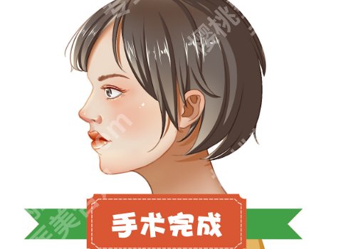 徐永丰缩鼻翼价格多少？低至1.5w起，附案例分享~