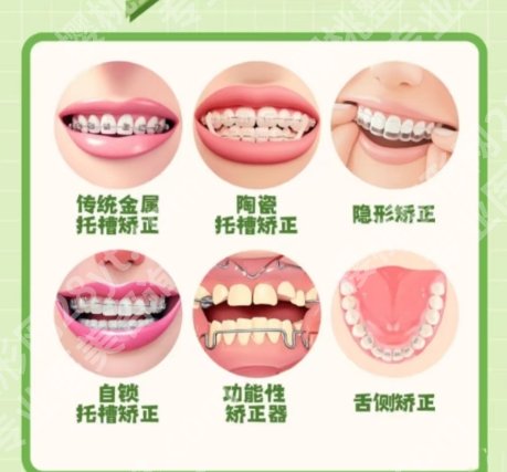 绍兴牙齿矫正医院推荐名单一览！市人民医院通通上榜！