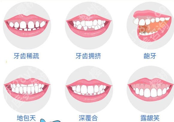 惠州牙齿矫正价格费用贵不贵？推荐几家靠谱又实惠的医院！含价格表