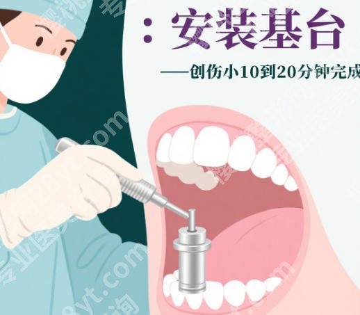 湖州市口腔医院种植牙价格贵不贵？收费表展示！看完不踩坑