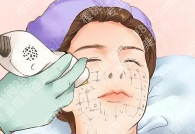 南宁点阵激光三甲医院多少钱一次？公立院真实费用出来了，附术后护理提醒